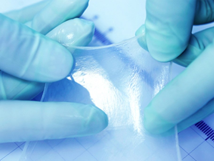 Next-Generation Wound Care: How Technology Is Shaping Skin Substitutes and Amniotic Skin Grafts