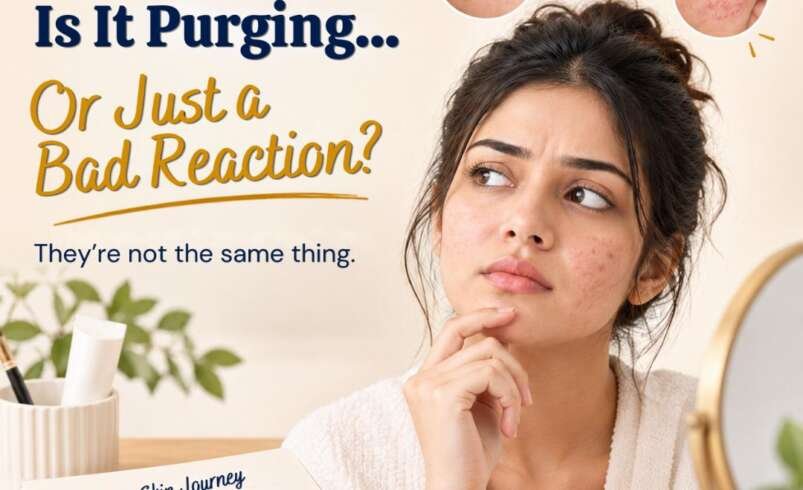 Chemical Peel Purging: Is It a Real Thing or Just an Excuse?