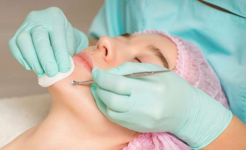 Acne Laser Treatment Price Damansara
